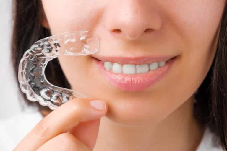 Frau mit Strayt Aligners in der Hand