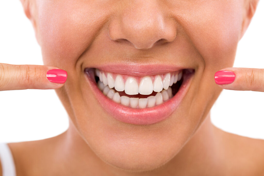 Young Woman pointing at her beautiful Teeth - Invisalign vs Braces