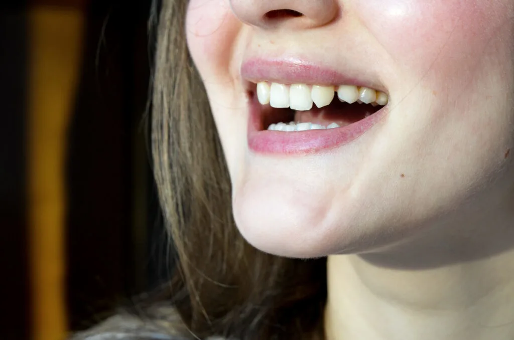 Kvinna ler strålande in i kameran - myter om tandställning
