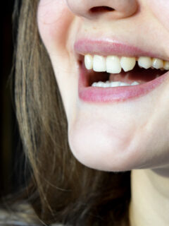 Frau lächelt strahlend in die Kamera - Mythen über Zahnspangen