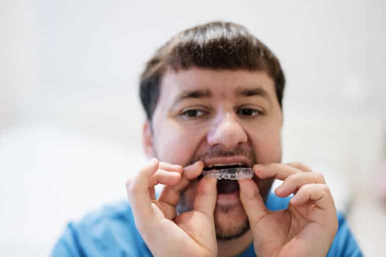 ¿Con qué rapidez se mueven los dientes con los aparatos de ortodoncia?